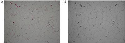 AdipoCount: A New Software for Automatic Adipocyte Counting